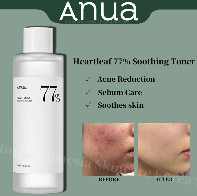 ANUA Heartleaf Toner 250ml – Calming & Moisturizing