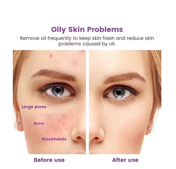 Volcanic Stone Face Oil Roller – Skincare Tool