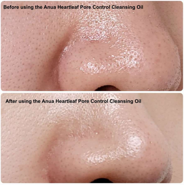 ANUA Heartleaf Cleansing Oil – Daily Blackhead Remover, 200 ml